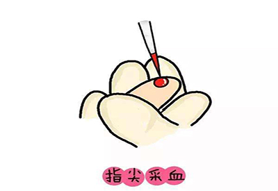 儿童91视频一区二区三区微量元素的检测项目有哪些 儿童91视频一区二区三区微量元素的检测项目有哪些