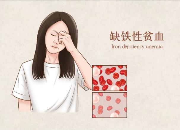 微量元素测试仪品牌-山东国康gk-缺铁性贫血到底是怎么回事?如何预防?